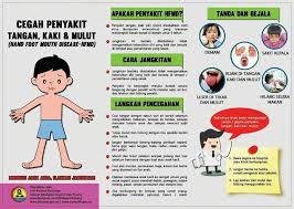 Cara merawat hfmd penyakit kaki tangan dan mulut dengan berkesan. Penyakit Tangan Kaki Dan Mulut Hfmd Blog Umi Anak 5