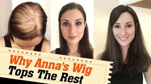 Doctors, hairstylists and beauty experts, and real users share their success stories with viviscal hair growth and hair care products. 5 Hair Loss Success Stories Customer Video Journals