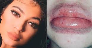 The Kylie Jenner Lip Challenge Is Strange And Unhealthy