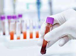 Os valores normais listados neste site não são aplicáveis em todos os hospitais. Exame De Sangue Veja Os Tipos Qual O Jejum Preparo E Mais
