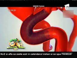 Aceste anomalii vasculare sunt clasificate in functie de patogeneza. Totul Despre Anevrismul Cerebral Youtube