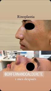 Dr Fernando Alderete Cirujano (@drfernandoalderete) • Фото и видео в  Instagram