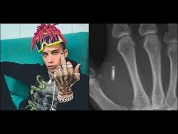 Kid Buu Gets Micro Chipped Prooves He Has A Clone On Ig Live New Music Youtube Music