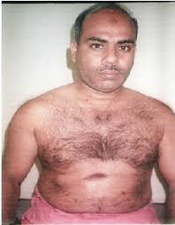 PORT-SITE TUBERCULOSIS AFTER LAPAROSCOPY