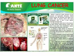 Pin On Deseases Health And Benifits Of Sante Barley
