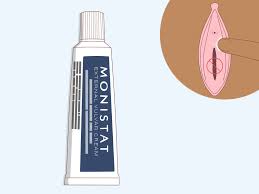 Suppositories feel awkward and gross but they do the job needed and clear up the . 4 Easy Ways To Apply Monistat Wikihow