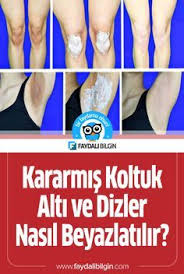 Kararmis Koltuk Alti Ve Dizler Nasil Beyazlatilir Faydali Bilgin Koltuk Alti Cilt Beyazlatma Dogal Cilt Bakimi