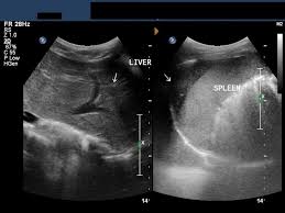 Maybe you would like to learn more about one of these? A Gallery Of High Resolution Ultrasound Color Doppler 3d Images Liver