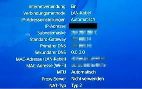 Please consult with your administrator. Ps4 Nat Typ Andern Das Bringt Es Und So Geht S