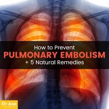 pulmonary embolism 5 natural remedies for prevention dr axe