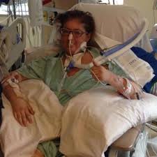 Mukoviszidose, auch zystische fibrose (zf) genannt, bewirkt, dass die körpersekrete in der bauchspeicheldrüse, der lunge und anderen organen sehr zäh sind. Mukoviszidose Mutter Uberlebt Im Krankenhaus Sechs Tage Ohne Lunge Gesundheit