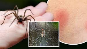 When spiders bite, the vast majority of bites only cause a mild reaction in people, such as minor swelling, inflammation, or itching. How To Recognise And Treat Spider Bites As They Enter Mating Season Heart