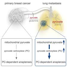 Breast cancer can potentially spread outside the breast through blood vessels and the lymphatic system to other parts of the body. Breast Cancer Derived Lung Metastases Show Increased Pyruvate Carboxylase Dependent Anaplerosis Sciencedirect