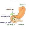 Most cases of stomach cancers are gastric carcinomas, which can be divided into a number of subtypes, including gastric adenocarcinomas. 1