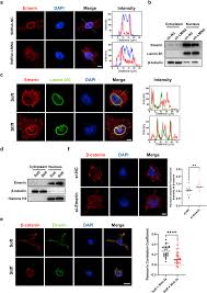 Chromatin remodeling and nucleoskeleton synergistically control osteogenic  differentiation in different matrix stiffnesses