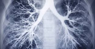 While the nhs test and trace system has been. What Does Coronavirus Do To The Lungs Houston Methodist On Health