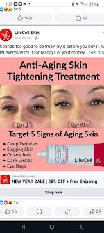 Has anyone had Q lift please ? Just starting my research