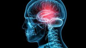 Image result for Brain Lesion