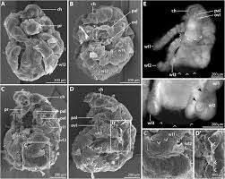 Image result for Pycnosphaera