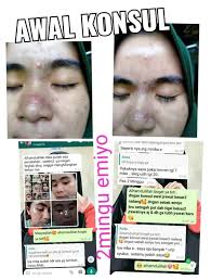 Arti weton jodoh ketemu 25. Emiyo Cosmetics Home Facebook