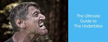 This can make a face appear long and flat the negative effects of having an underbite depend on how severe the condition is. What Is An Underbite And What Can Be Done About It Dental Aware Australia
