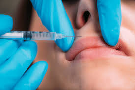 Image result for Dermal Filler Injection