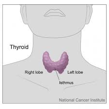 Papillary or follicular thyroid cancer in a person younger than 55. Thyroid Cancer Cancerquest