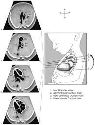 Aium Practice Guideline For The Performance Of Fetal Echocardiography Obstetric Ultrasound Medical Ultrasound Ultrasound Technician