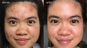 CÔNG THỨC RETINOL ZO SKIN HEALTH CẢI THIỆN SẮC TỐ DA VÀ TRẺ HÓA