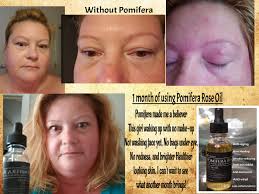 Amazon.Com: Maclura Pomifera Essential Gold Oil, 100% Pure Cold Pressed  Osage Orange Seed Oil, 15 Ml : Beauty & Personal Care