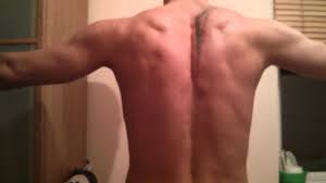 Muscles of the back can be divided into superficial, intermediate, and deep group.since the all the back muscles originate in embryo (fetus) form by locations other than the back. Scapula Muscles Reference Youtube