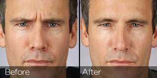 Ian Elder (@ianelder001)