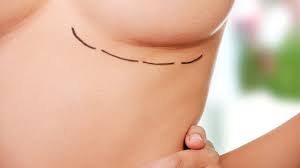 how to pick a breast implant size plastic surgery