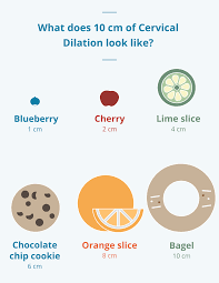 Cervix Dilation Chart Stages Of Labor