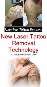 As a result, they often offer a better price range than the other facilities that have more than one area of expertise. Picosure Laser Tattoo Entfernung Tattoo Entfernung Neues Tattoo Tattoo Entfernung Sal E Tattoo Removal Cream Tattoo Removal Natural Acne Scar Treatment