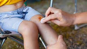Jadi ada baiknya orangtua selalu mengawasi kegiatan anak agar tidak sampai terkena virus atau. Anak Sering Jatuh Waspada Terkena Cedera Lutut Kumparan Com
