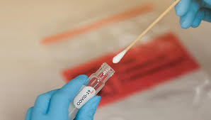 The rapid covid pcr swab test is administered at the point of care by nasal swab by a licensed medical assistant or primary care provider. Noul Coronavirus Si Testarea Pentru Covid 19 Reginamaria Ro