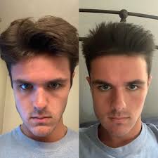 Not shampooing too often, avoiding heat treatments and not styling. Help How Long Until My Hair Grows Back To The Way It Was On The Left The Barber Thinned Our My Hair With Special Scissors Too So How Long Until It Gets