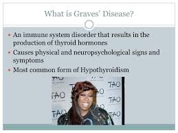 MONTANA WRIGLEY & SIERRA RYALS Graves Disease. What is Graves' Disease? An  immune system disorder that results in the production of thyroid hormones  Causes.