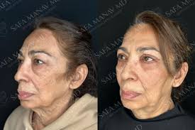 Dr. Dr Safa Manav Md