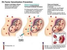 Image result for Rh Sensitization