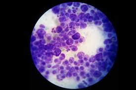 Image result for Mast Cell