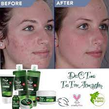 Tea Tree Skin Care Tea Tree Skincare Tea Tree Skin Care