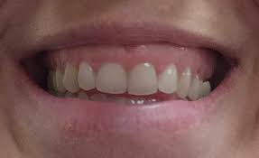 Want to improve your smile? Cosmetic Dentistry Dental Associates