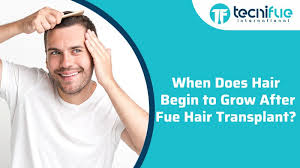 By 12 months all significant changes will stop, and the final result should be a head full of hair. When Does Hair Begin To Grow After Fue Hair Transplant Tecnifue