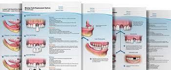 Dental Dental Implants Dentistry