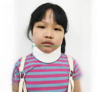 China OEM Paediatric Soft Neck Brace Orthopedic Cervical ...