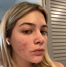 Manhattan Dermatology