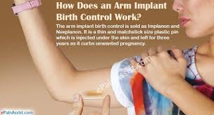 How Does Arm Implant Birth Control Work Birth Control Implant Arm Implant Birth Control Arm Implant