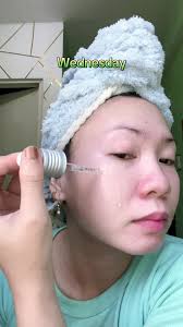 Azelaic Acid Serum: Why It's Banned in Korea?